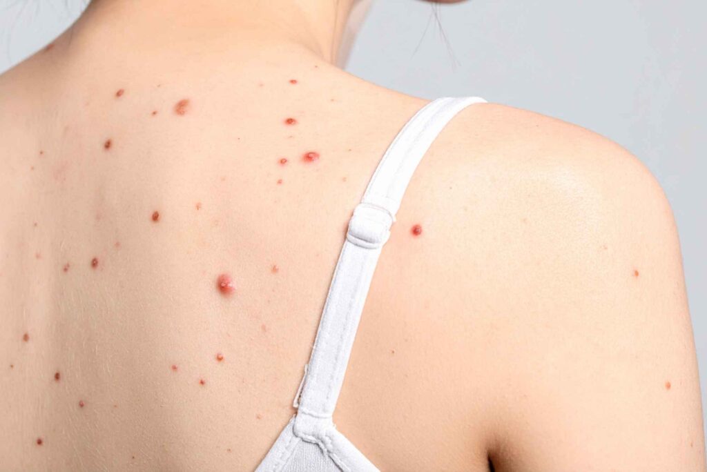 كل ما تحتاج معرفته عن تخصص الجلدية وأحدث طرق علاج مشاكل البشرة كل ما تحتاج معرفته عن تخصص الجلدية وأحدث طرق علاج مشاكل البشرة